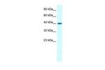 GFI1B Antibody in Western Blot (WB)