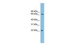 DYRK3 Antibody in Western Blot (WB)