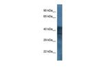 GABRB1 Antibody in Western Blot (WB)