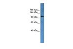 ZEB1 Antibody in Western Blot (WB)