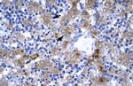 IRF9 Antibody in Immunohistochemistry (IHC)