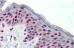 Fra1 Antibody in Immunohistochemistry (Paraffin) (IHC (P))