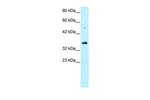 GTF2H3 Antibody in Western Blot (WB)