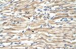 YAF2 Antibody in Immunohistochemistry (IHC)