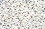 ZNF274 Antibody in Immunohistochemistry (IHC)