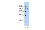 SUPT16H Antibody in Western Blot (WB)