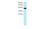 ZFP1 Antibody in Western Blot (WB)