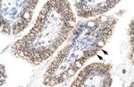 AEBP1 Antibody in Immunohistochemistry (IHC)