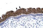 AEBP1 Antibody in Immunohistochemistry (IHC)