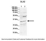 DLX2 Antibody in Western Blot (WB)