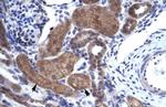 HELIOS Antibody in Immunohistochemistry (IHC)