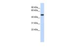 PDK2 Antibody in Western Blot (WB)