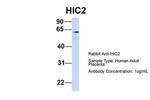 HIC2 Antibody in Western Blot (WB)