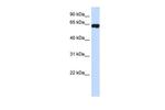 HIC2 Antibody in Western Blot (WB)