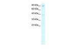 C20orf194 Antibody in Western Blot (WB)