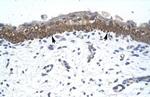 ZNF385A Antibody in Immunohistochemistry (IHC)