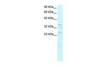 ZNF385A Antibody in Western Blot (WB)