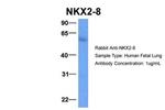 Nkx2.8 Antibody in Western Blot (WB)