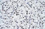 GLI2 Antibody in Immunohistochemistry (Paraffin) (IHC (P))