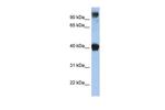 TFAP2E Antibody in Western Blot (WB)