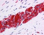 TLX Antibody in Immunohistochemistry (IHC)