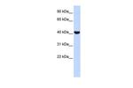 TLX Antibody in Western Blot (WB)