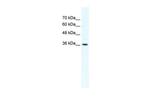 DVL1 Antibody in Western Blot (WB)