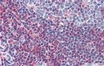 GSC Antibody in Immunohistochemistry (IHC)