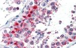 GSC Antibody in Immunohistochemistry (IHC)