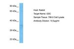 GSC Antibody in Western Blot (WB)