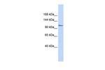 ZFPM1 Antibody in Western Blot (WB)