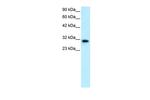 DBP Antibody in Western Blot (WB)