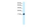 E2F6 Antibody in Western Blot (WB)