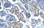 FOXF1 Antibody in Immunohistochemistry (IHC)