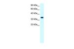 FOXF1 Antibody in Western Blot (WB)