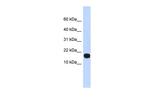 ID4 Antibody in Western Blot (WB)