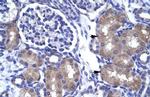 ASCL1 Antibody in Immunohistochemistry (IHC)