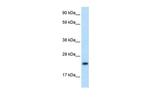 ASCL1 Antibody in Western Blot (WB)