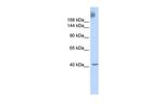 TAF1 Antibody in Western Blot (WB)