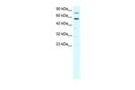 SND1 Antibody in Western Blot (WB)