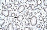 CITED1 Antibody in Immunohistochemistry (IHC)