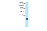 CITED1 Antibody in Western Blot (WB)