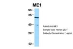 ME1 Antibody in Western Blot (WB)