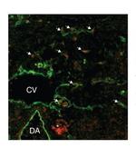 SOX18 Antibody in Immunocytochemistry (ICC/IF)