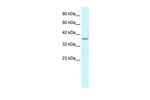 SOX18 Antibody in Western Blot (WB)