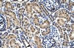 PHKG2 Antibody in Immunohistochemistry (IHC)