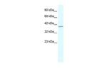 PHKG2 Antibody in Western Blot (WB)