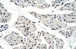 RALY Antibody in Immunohistochemistry (IHC)