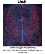 LHX5 Antibody in Immunohistochemistry (IHC)