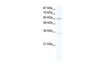 ZNF668 Antibody in Western Blot (WB)